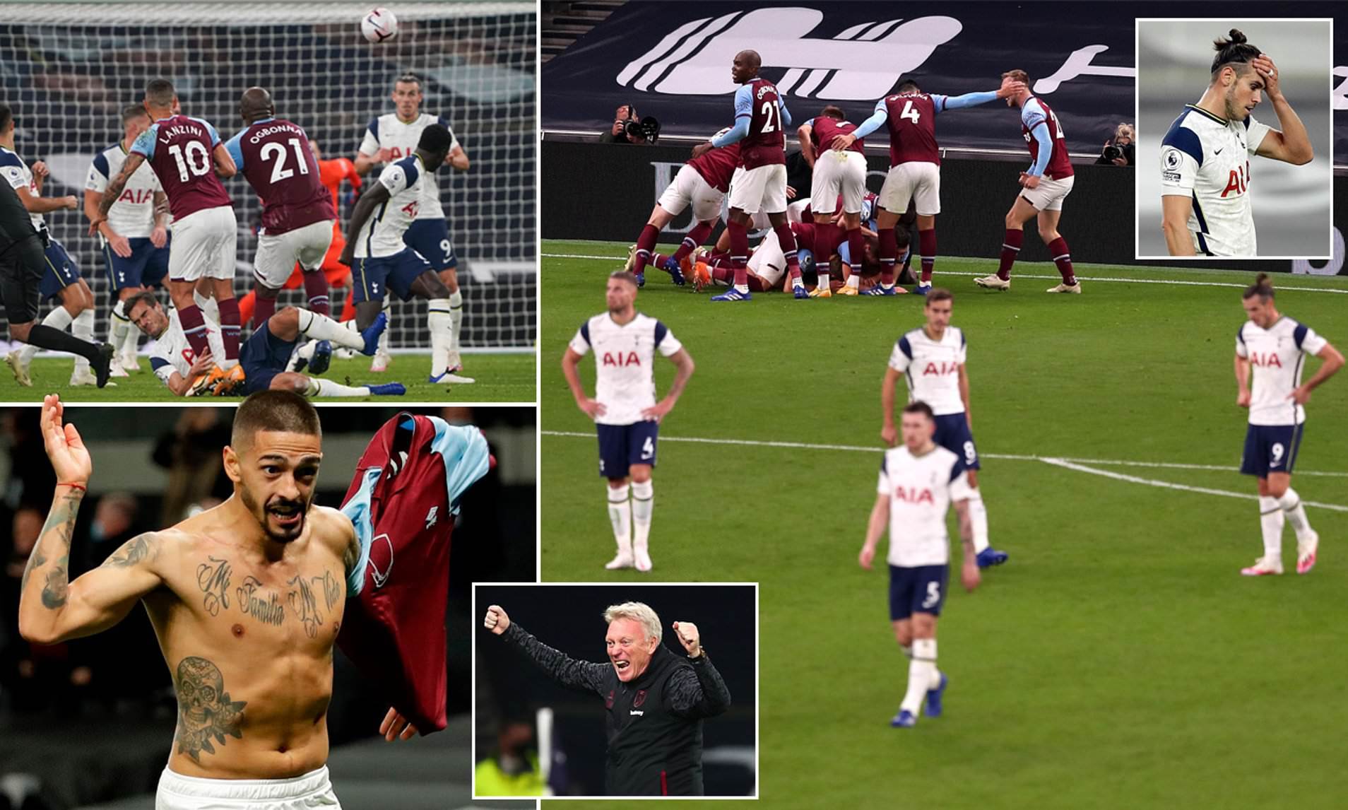 这是踢球？全运会惊现暴力犯规致受伤球员腓骨骨折.